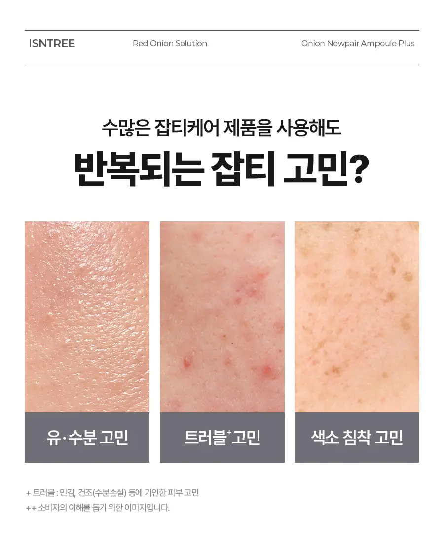 [리뉴얼] 이즈앤트리 어니언 뉴페어 앰플 플러스 50ml 상세페이지 7